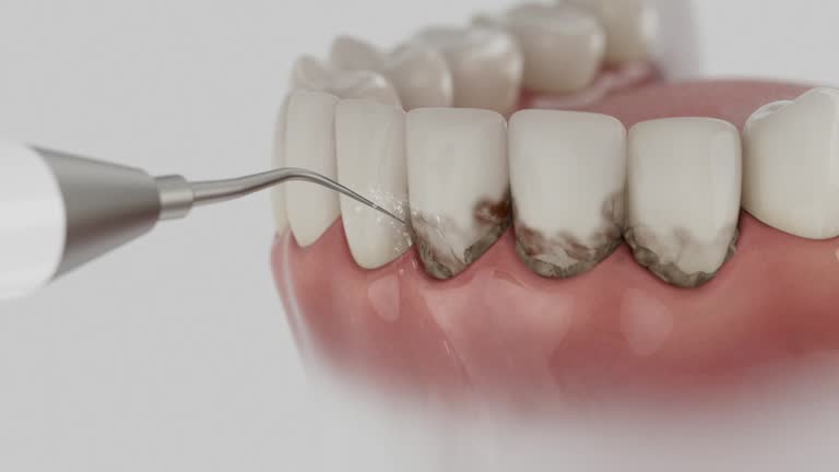 Trusted Teeth Cleaning And Checkup service in White Pine, TN - Dentist Open Now